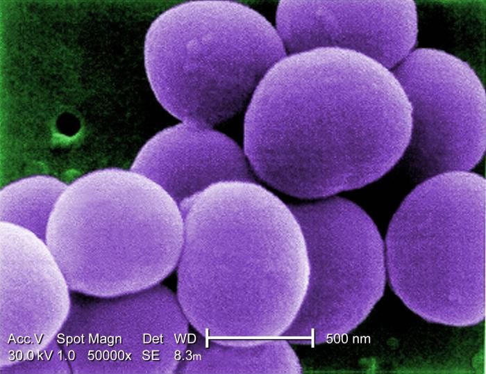 Figure 2. MRSA photo showing the purple Gram stain of <i>Staphylococcus</i>. (CDC stock photo)