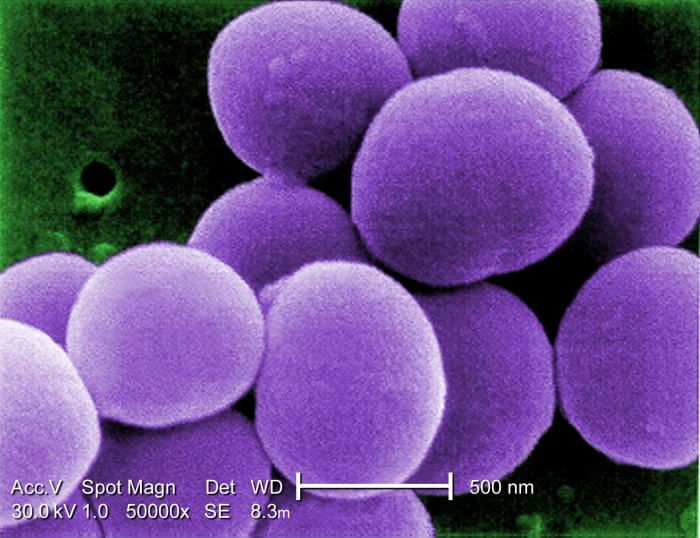 Staphylococcus aureus: a new mechanism involved in virulence and antibiotic  resistance - News from the Institut Pasteur