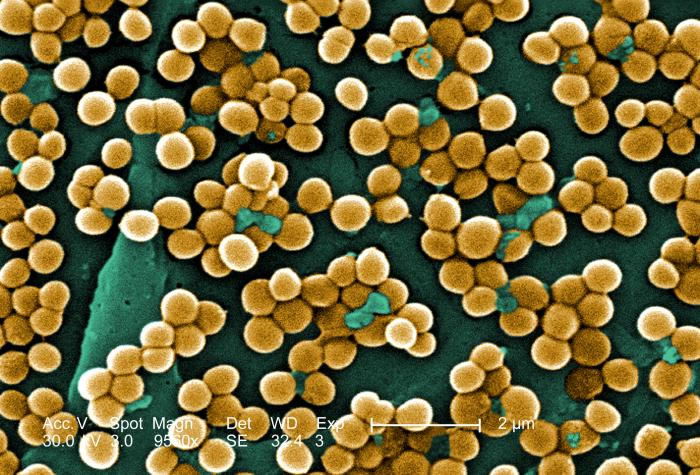 Figure 1. MRSA photo showing the golden color of <i>Staphylococcus aureus</i>. (CDC stock photo)