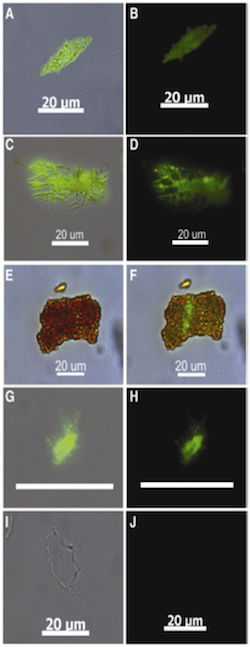 Ab-labeled osteocytes