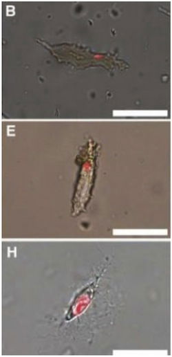 osteocytes