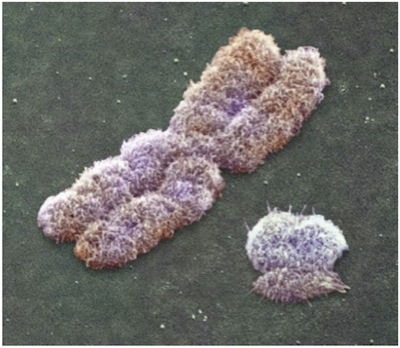 Chromosome