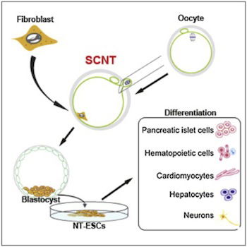 SCNT method