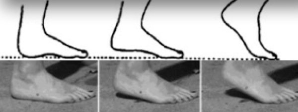 foot-comparison