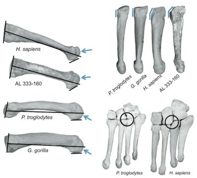 bone comparison