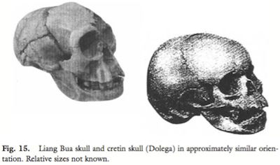 dmanisi-cretin