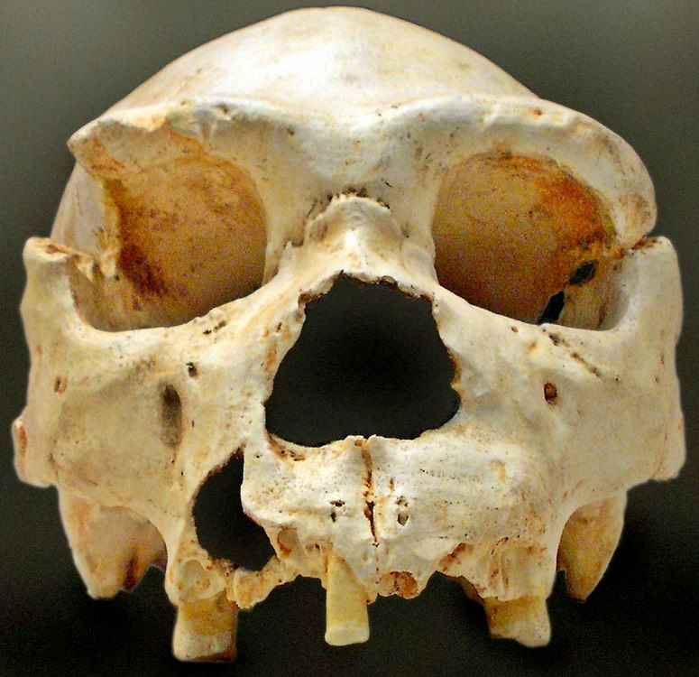 Homo heidelbergensis Cranium