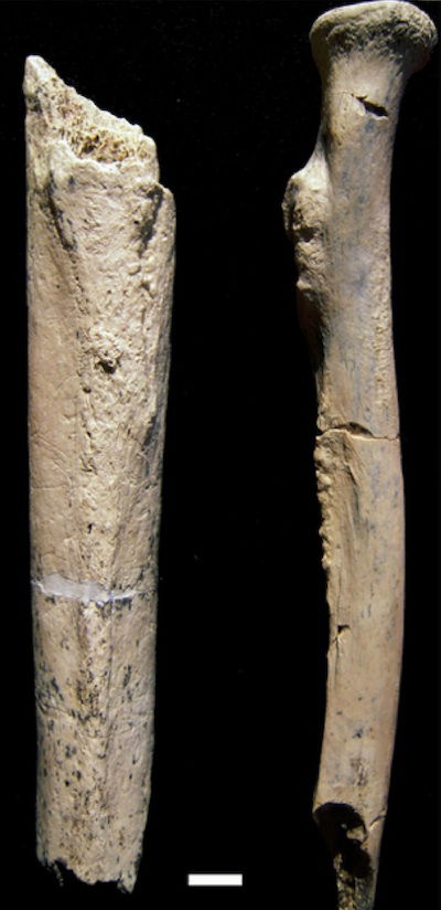 nutcracker femur