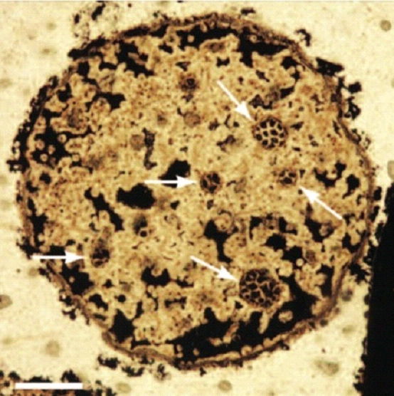 Megasphaera cell nests