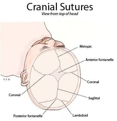 sutures