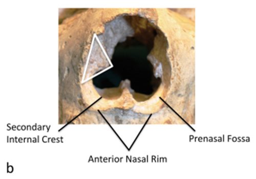 Neanderthal Nose
