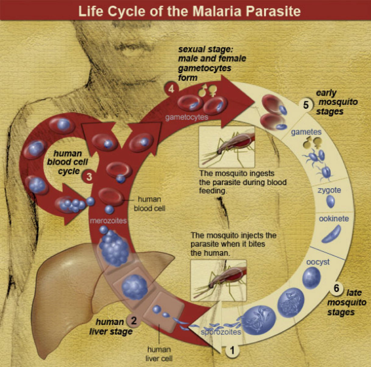 malaria