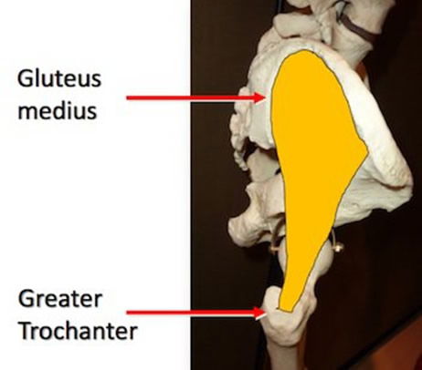 Hip Diagram