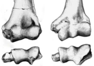 Does the Fossil Gibbon in the Gap Monkey with Human Ancestry? | Answers