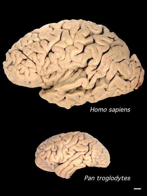 Brain Comparison