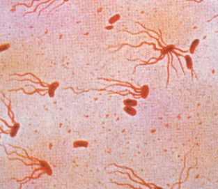 Salmonella typhi