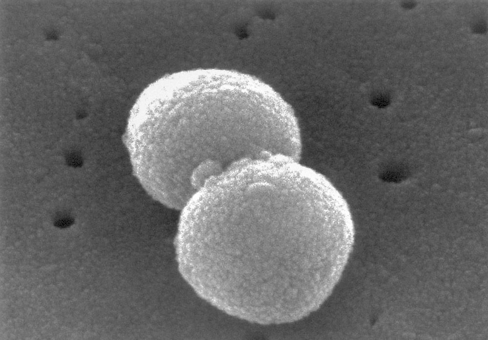 Streptococcus pneumoniae