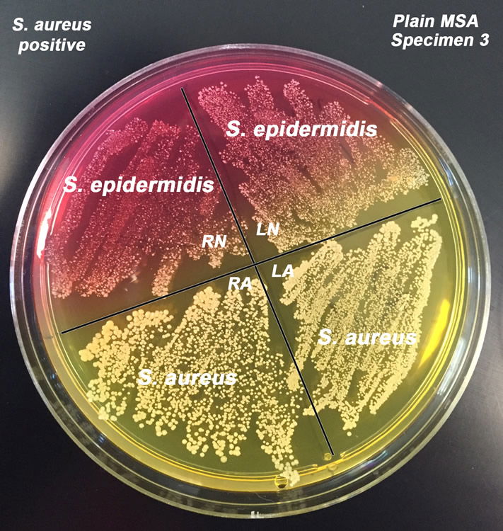 Staph Bacteria From First Breath Answers In Genesis