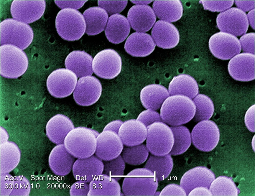 Pictures Of The Bacteria Staphylococcus Aureus 55