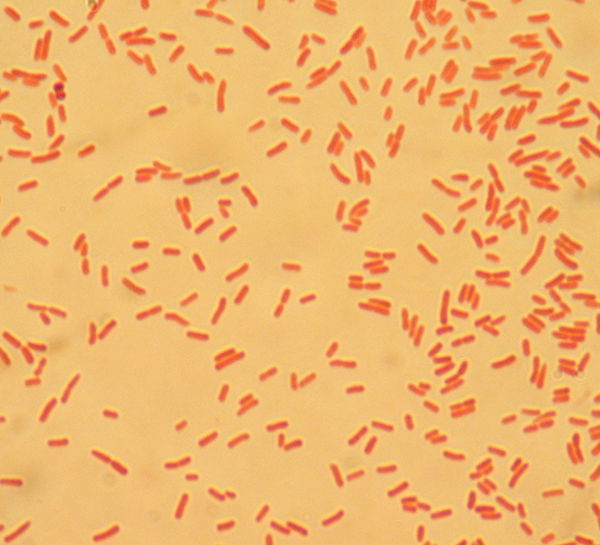 Gram Negative Rods E Coli