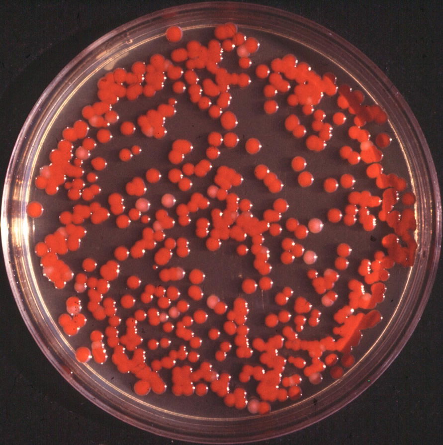 Serratia marcescens