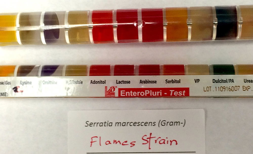 Enterotube Results