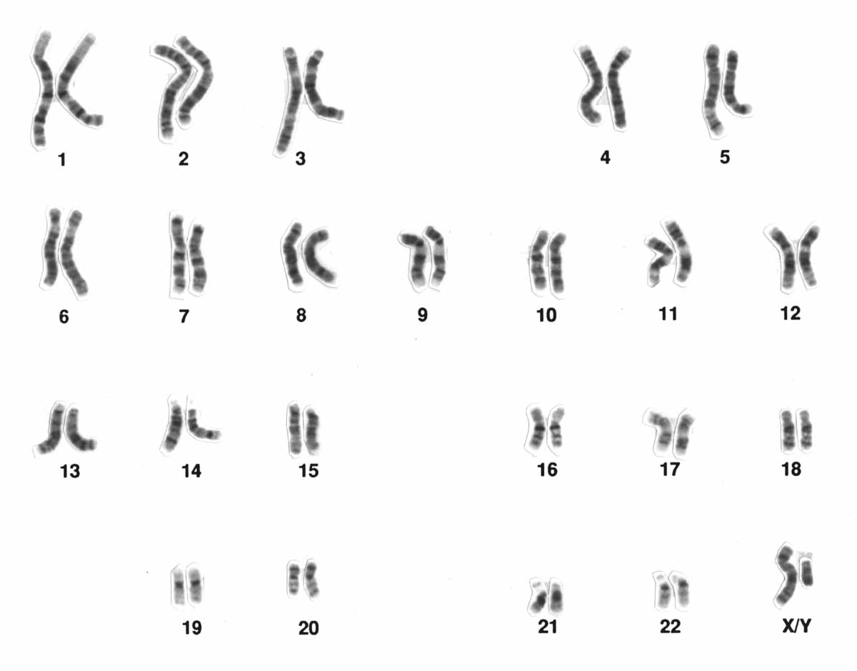 Human male karyotype