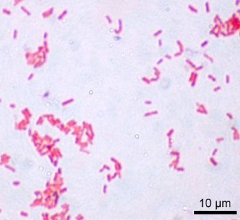 Figure1: E. coli gram stain