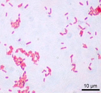 Figure1: E. coli gram stain