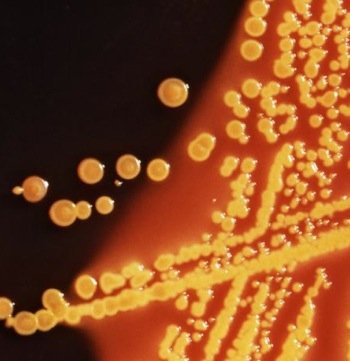 Figure3: E. coli colonies