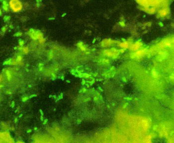 Figure6: <i>E. coli </i>chronic diarrhea