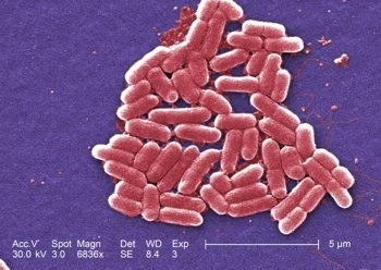 Figure7: <i>E. coli </i>chronic diarrhea