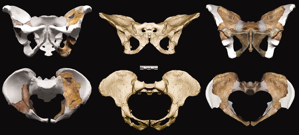 Comparison of MH1 and MH2 Pelves