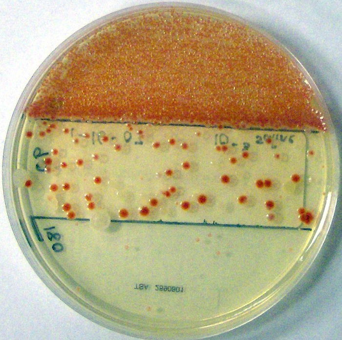 serratia marcescens bacteria