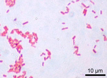 Serratia Figure 2