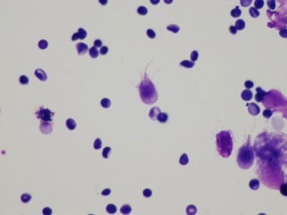 Giardia