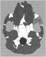 skull base view