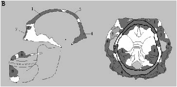 skull view