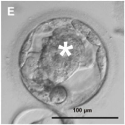 clone blastocyst