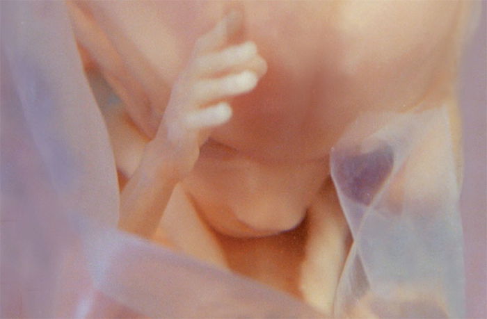 Unborn Baby