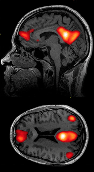 Brain Scan