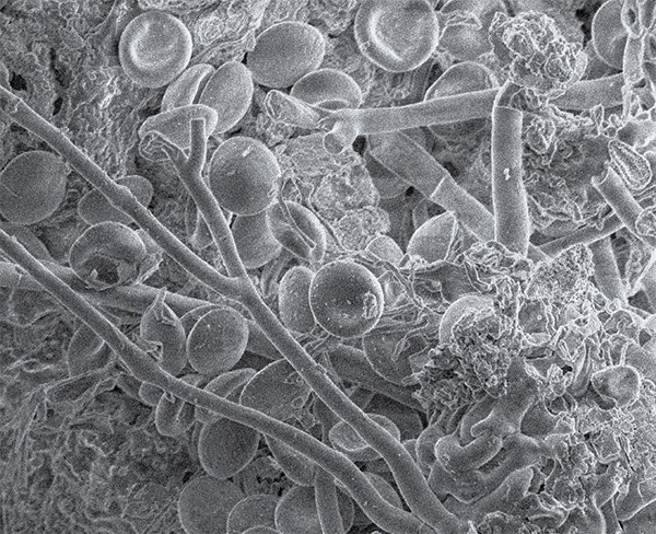 Wasp Blood Cells