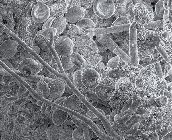 Wasp Blood Cells