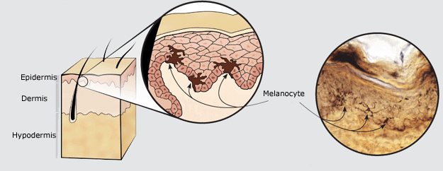 Melanin: Figure 1