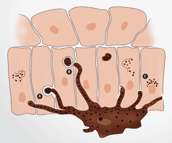 Melanin—umbrellas Of Our Skin Answers In Genesis