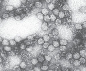 Influenza Virus