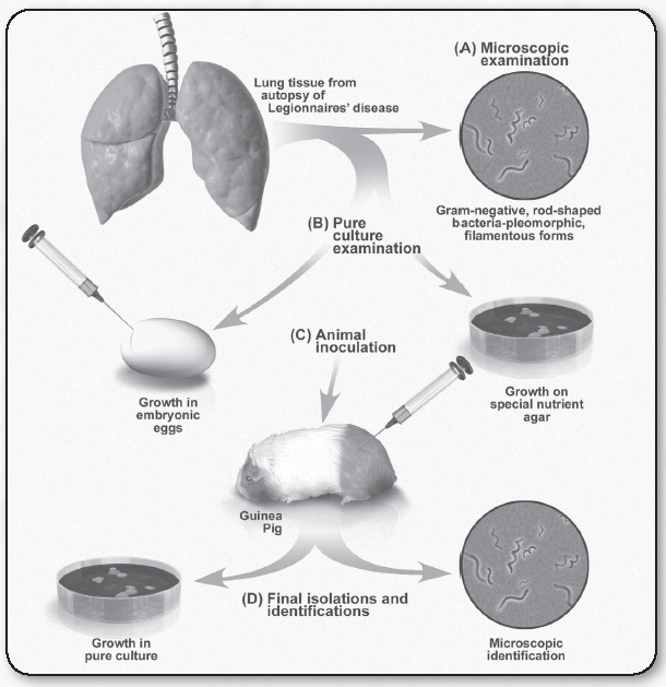 Legionnaires' Disease Investigation