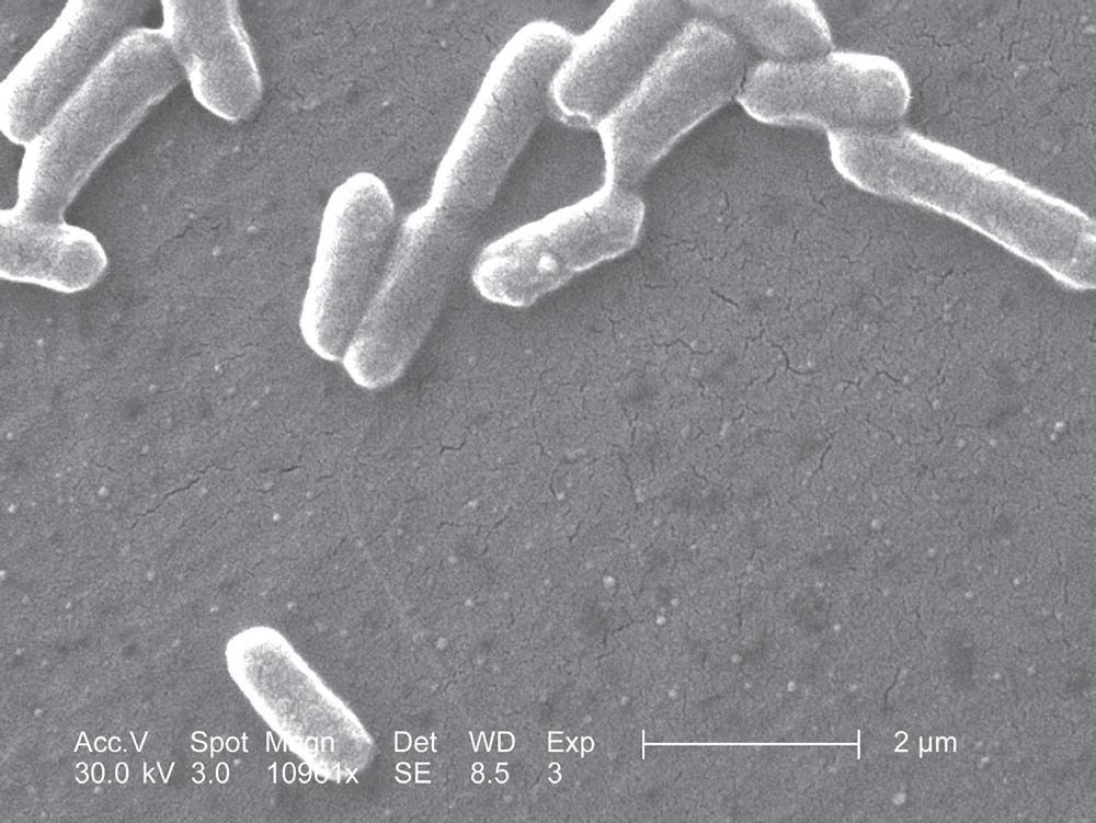 Scanning Electron Micrograph of E. coli