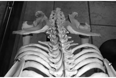 Chimp Iliac Blades