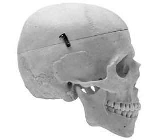 Human Skull